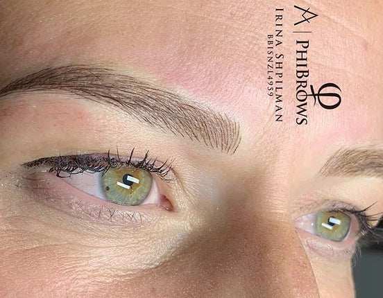 image comparison after