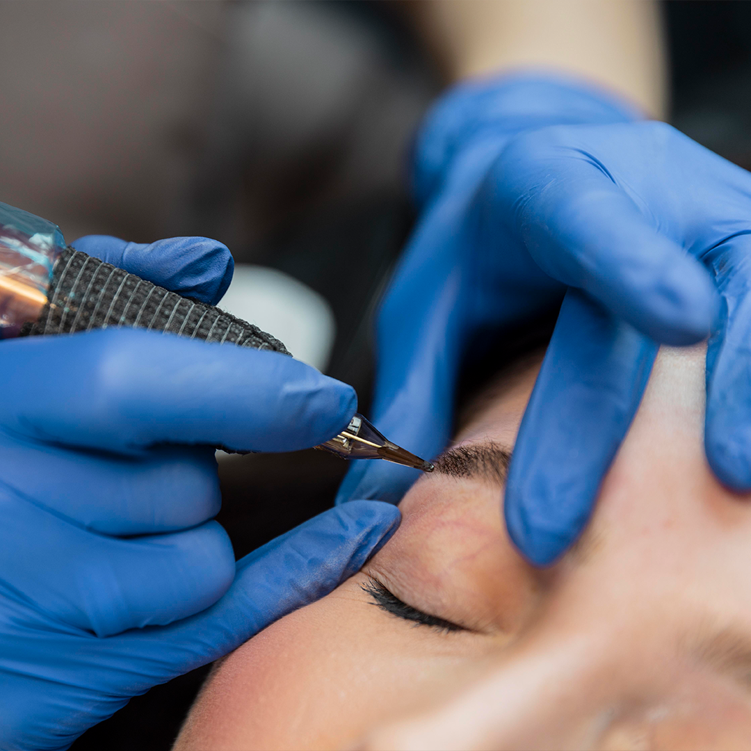 Nano hairstroke eyebrow tattoo technique is a precision method of creating ultra-fine, realistic eyebrow hair strokes using a special nano-needle. This technique is similar to microblading but utilizes a smaller, more delicate needle, allowing for even finer and more detailed strokes that closely mimic natural eyebrow hairs.